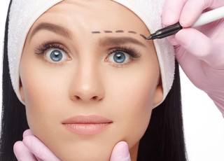 Eyebrow Lift Procedure