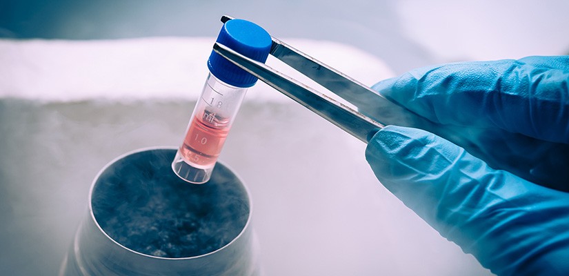 Kliniğimizde Kök Hücre Uygulamaları